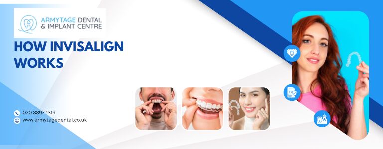 How Invisalign works