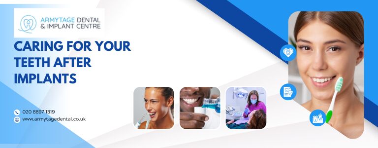 Caring for your teeth after implants