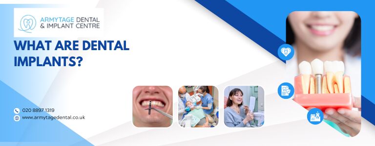 What are dental implants?