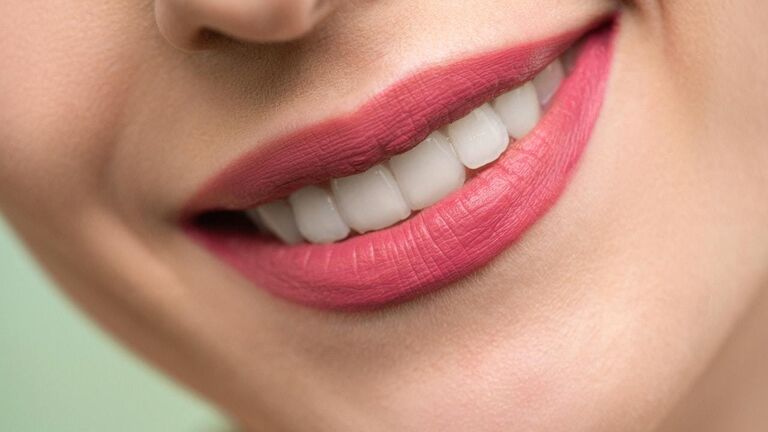Teeth whitening