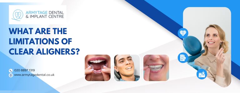 What are the limitations of clear aligners