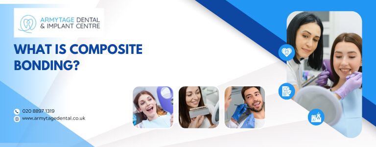 What is composite bonding
